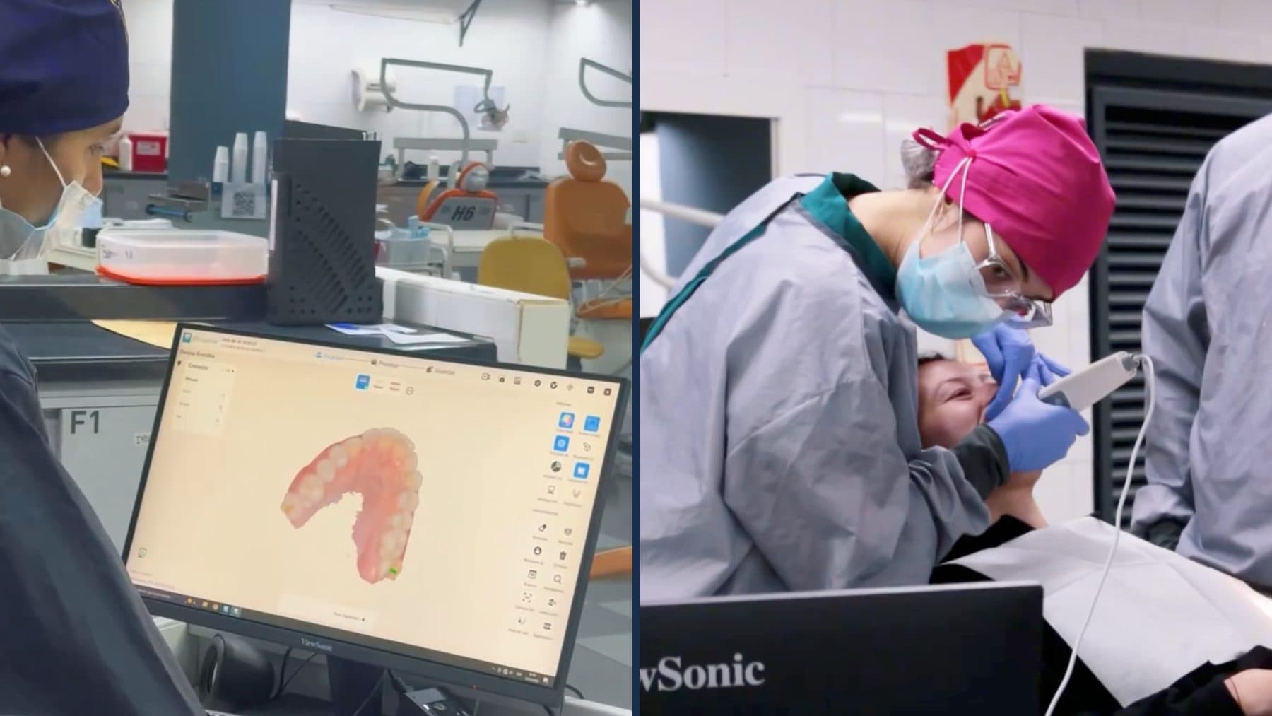 A la izquierda, la impresión digital de una arcada dental en la pantalla del laboratorio; a la derecha, una odontóloga escanea la boca de una deportista en el sillón